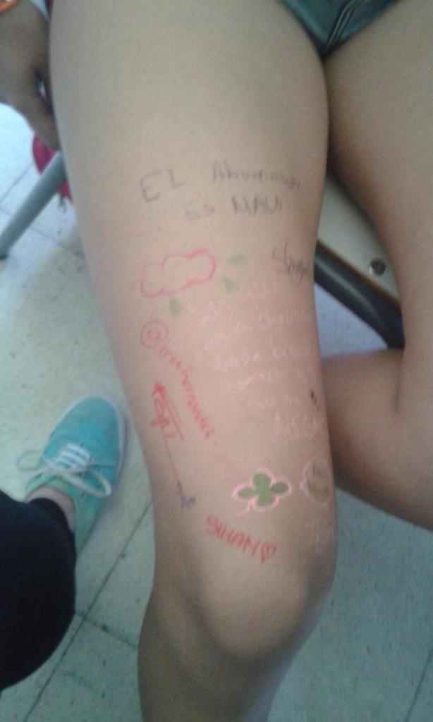 IreeHernandez's tweet photo. Nos aburrimos mucho en clase y que forma mas bonita de pasar el tiempo... a pintarle la pierna a @LauraMatas16 http://t.co/hCo7JN9HzD