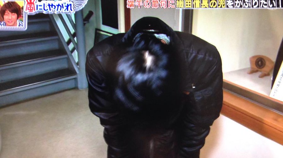二宮和也のハゲ 薄毛 疑惑メンバー不仲説が原因 あの人は今