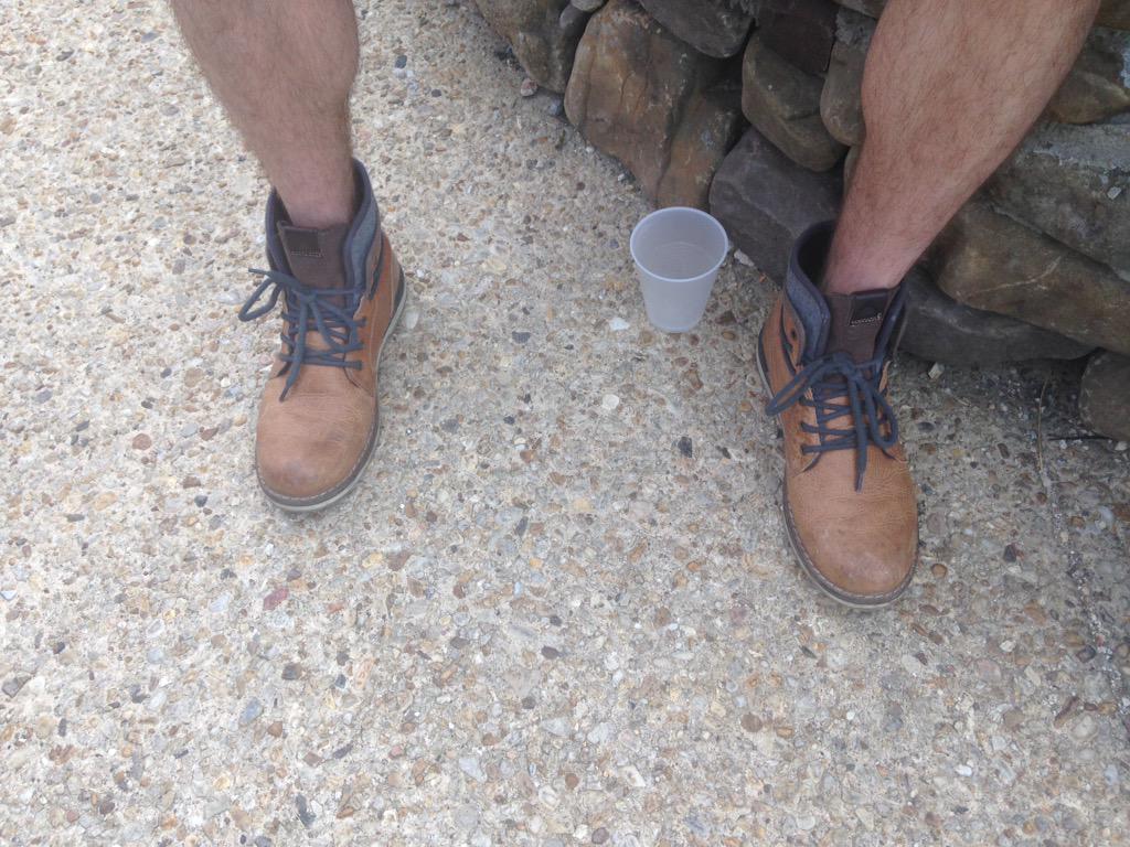 Runnindeadrelay's tweet photo. Lesson learned. Should of run in these.  
#AOR2015 #VibramsHurt http://t.co/MQ9NBnRaw2