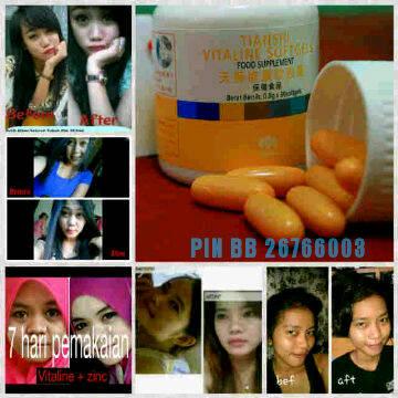 OutletHerbalcom's tweet photo. Wow! Pemutih herbal utk wajah Dan seluruh tubuh. Mau? Invite PIN: 5867E7EE
WA: 085703148181 #AMPUH https://t.co/LCT4naSxh9