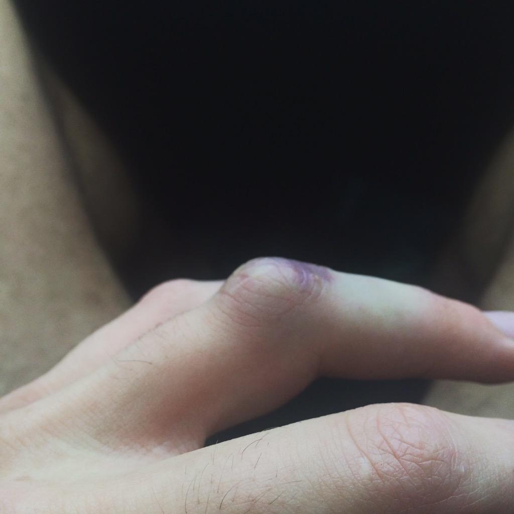 samuelpine's tweet image. 🙈🙈😂😂 #dislocated