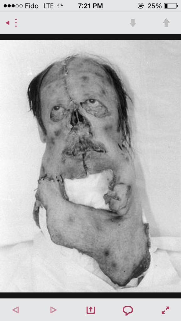 How Manny looked like after the fight.