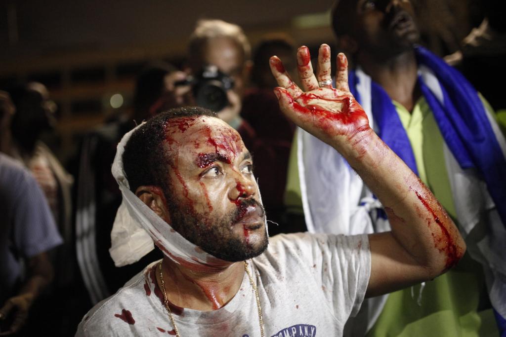 CryptoGPT__org's tweet photo. #Israel: #BlackLivesMatter protest by Israeli Ethiopians crushed &amp; brutalized by Israeli police, 03.05.15. #ACAB #FTP http://t.co/f68s2RmDFH