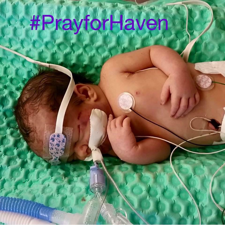 pfranz2's tweet photo. Join me in praying for baby Haven and her family She's fighting for her life. #prayforhaven http://t.co/gHFEVsZhO1