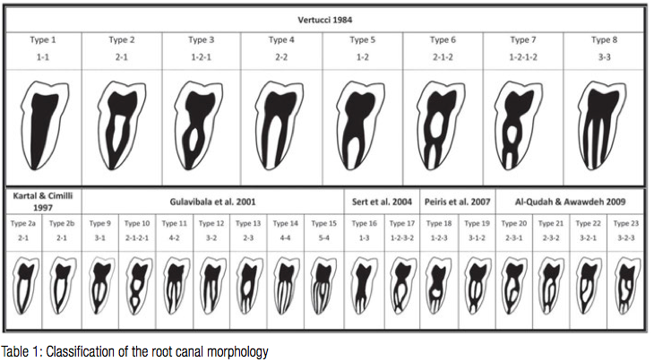 Сколько каналов в 16. Классификация корневых каналов Vertucci. Типы конфигурации корневых каналов по Вертуччи. Топография корневых каналов 16 зуба. Корневые каналы зубов схема.