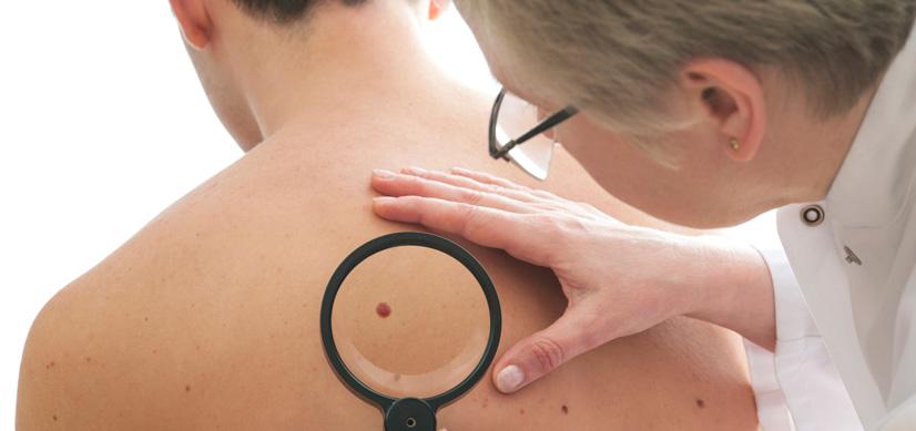 DukeCancer's tweet photo. Today is #MelanomaMonday! Here is how to detect this form of #skincancer: http://t.co/FQEhSeDK2d http://t.co/WS6ShKdJip