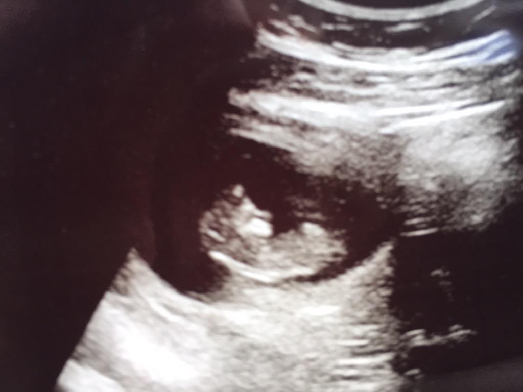 berncoh's tweet photo. Good morning! I'm growing a tiny human. #13weeks #grateful #helladitto http://t.co/YcbgWrK8OT