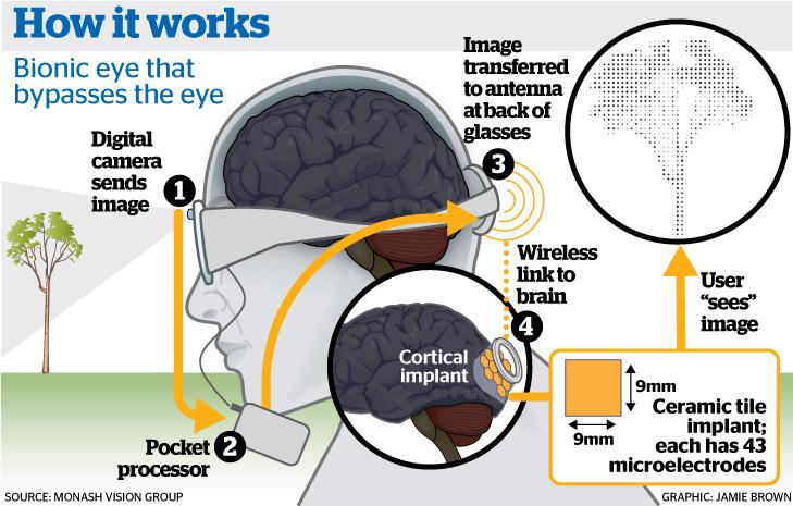 Science_Academy's tweet photo. Human trials for bionic eye with 'wireless brain chip' to start next year http://t.co/0ep7qTkcx4 http://t.co/p7pvBIOPTW