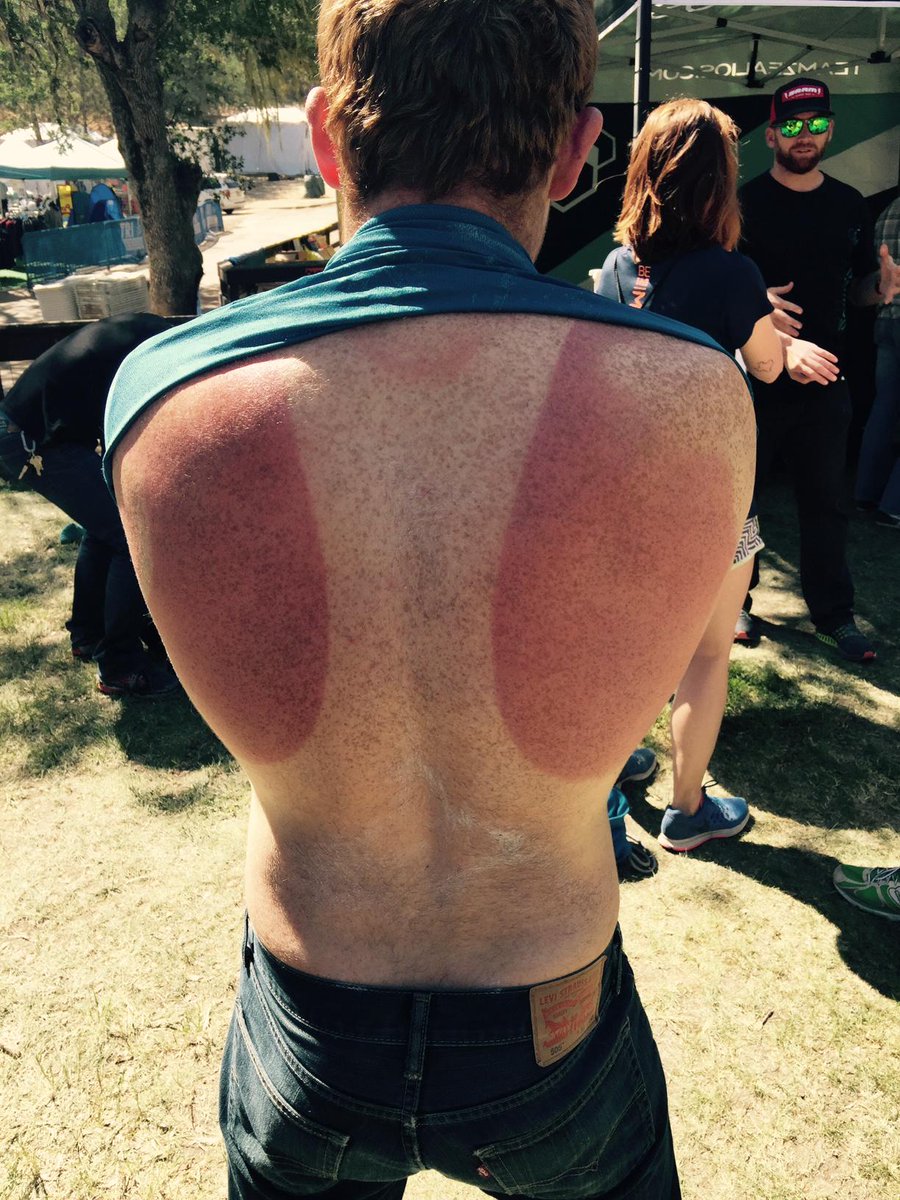 teamzealios's tweet photo. Don't be "that guy"! Should have stopped by our booth at @TriCalEvents Wildflower Triathlon! #raceprepared http://t.co/w7OX9UItb2