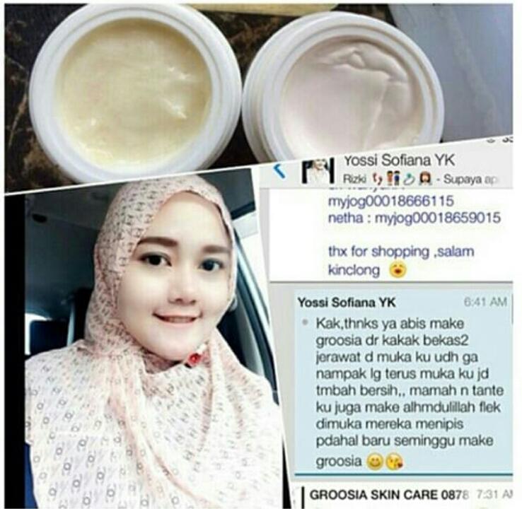 Srisavira's tweet photo. Ingin tampil lebih cantik pakai GROSSIA ☺ ayoo buruan yg belom pakai cream cantik ini segera order 😘 pin bb 5551ba4e http://t.co/hCsVmh0O9G