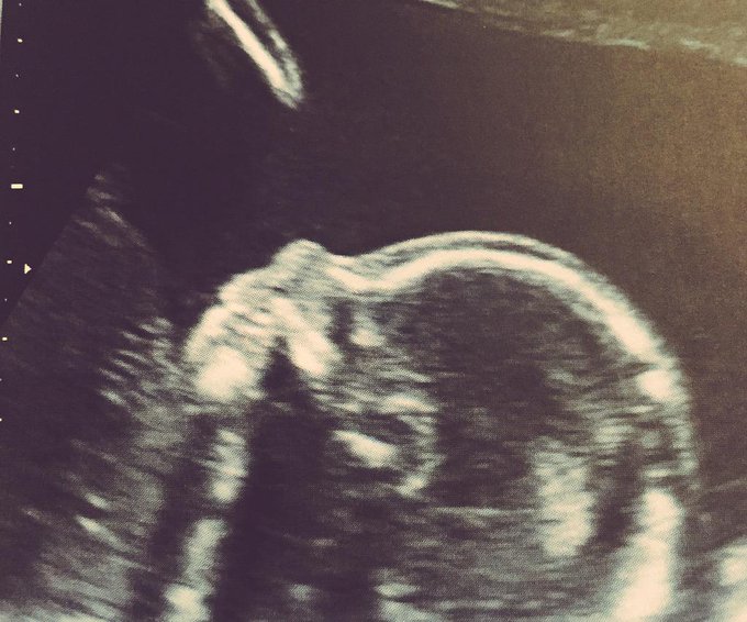 Os presento a mi segunda hija Carlota. Ya tiene 20 semanitas! ☺️☺️☺️☺️ http://t.co/vZO20UO24P<a href="/tag/10oct"class="tags"><span>#10oct</span></a>