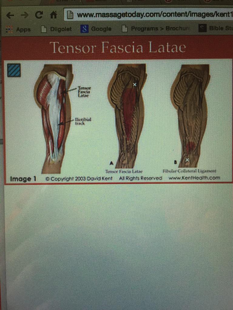 ahildebrand10's tweet photo. "I'd like a medium Tensor Fascia Latae, no whipped cream please" #anatomyjokes 💪🏼☕️ http://t.co/8iD9jJ8Maj