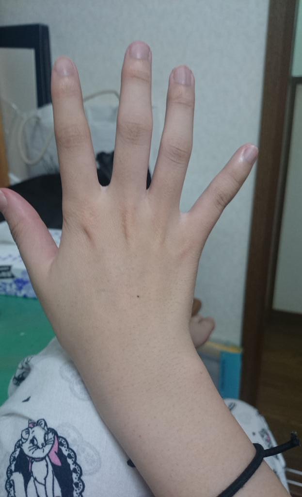 手の甲のほくろの意味は 右手左手で意味が違う手のほくろ占いについて解説 セレスティア358