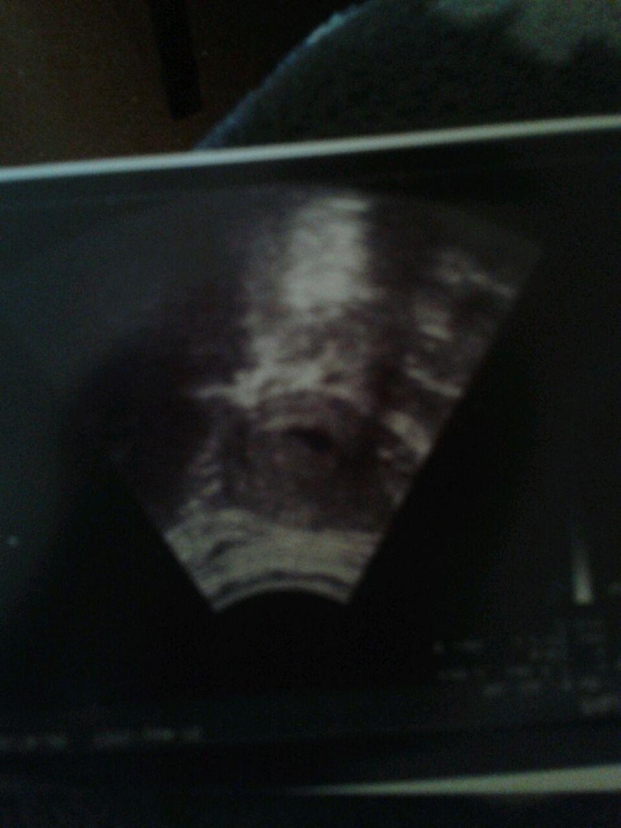 JessicaConejero's tweet photo. Mi madre me ha dado lo mejor que tengo, mi hermana y mi futuro pequeñin ♡ http://t.co/JekE0E4QqX