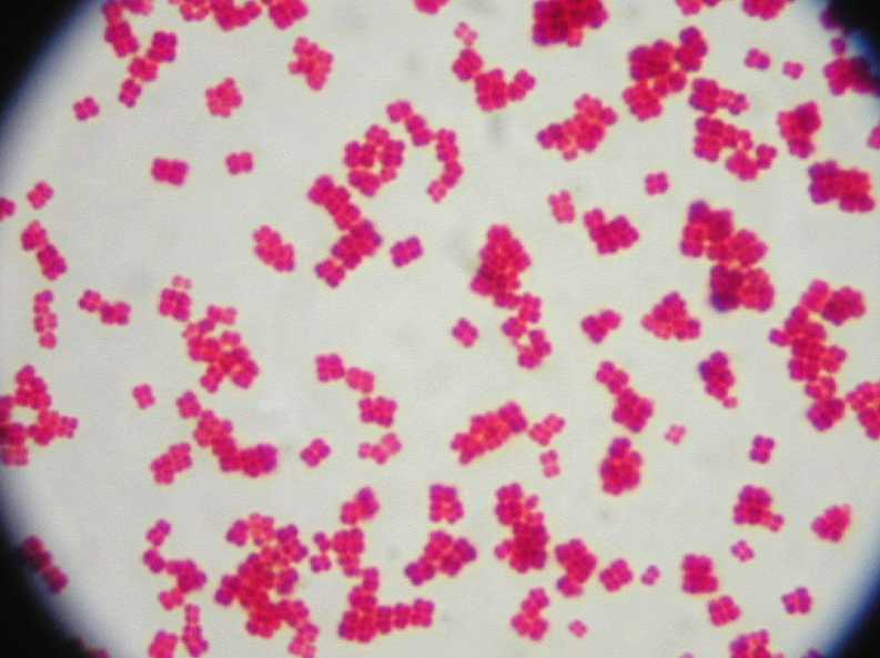 gram negative bacilli gram negative bacilli