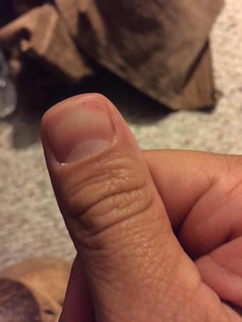 cchillzone's tweet photo. my thumb after watching ur long ass snapchat story http://t.co/Gf1EObNrpP