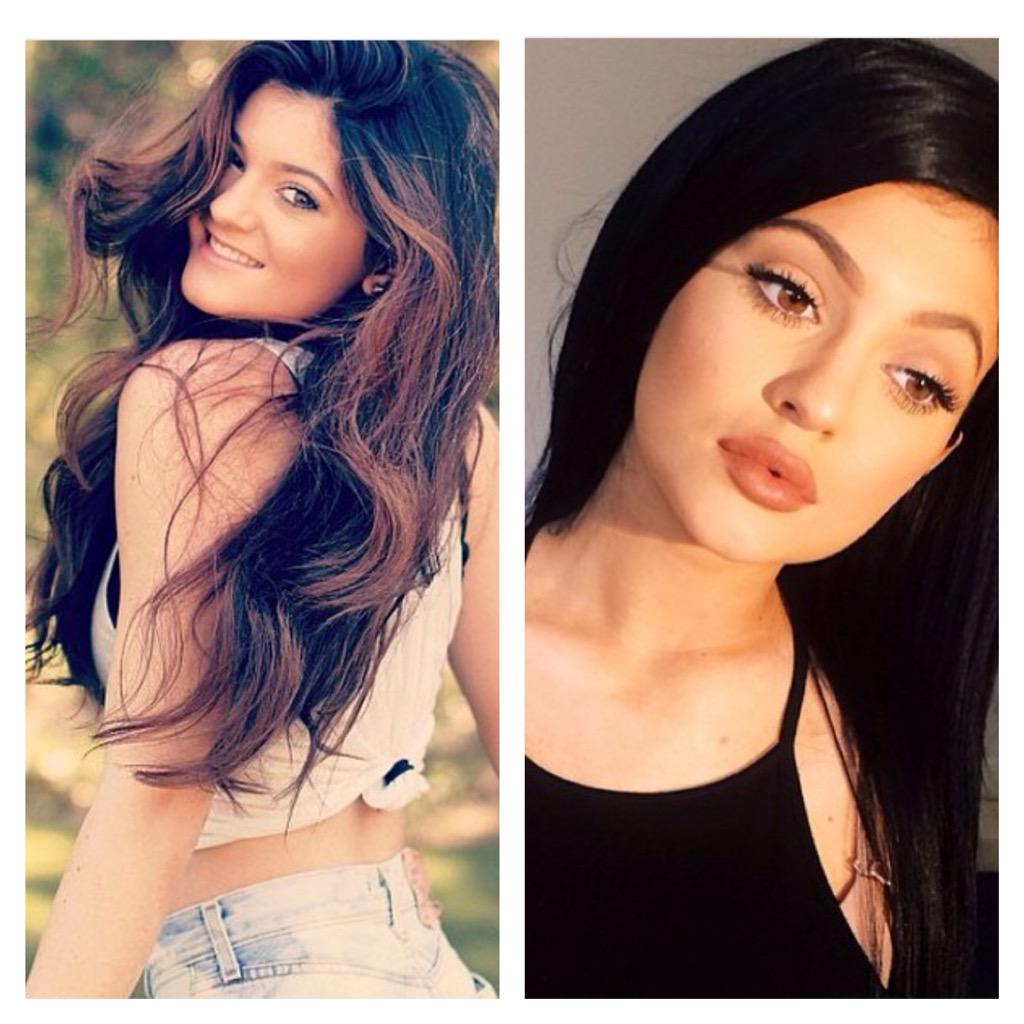 lipstickissed's tweet photo. #KylieJenner finally being honest about the lips #WhenYourMomIsAPimp you can do whatever be4 18 #lipstickissedinfo http://t.co/jwPMcDc6yD