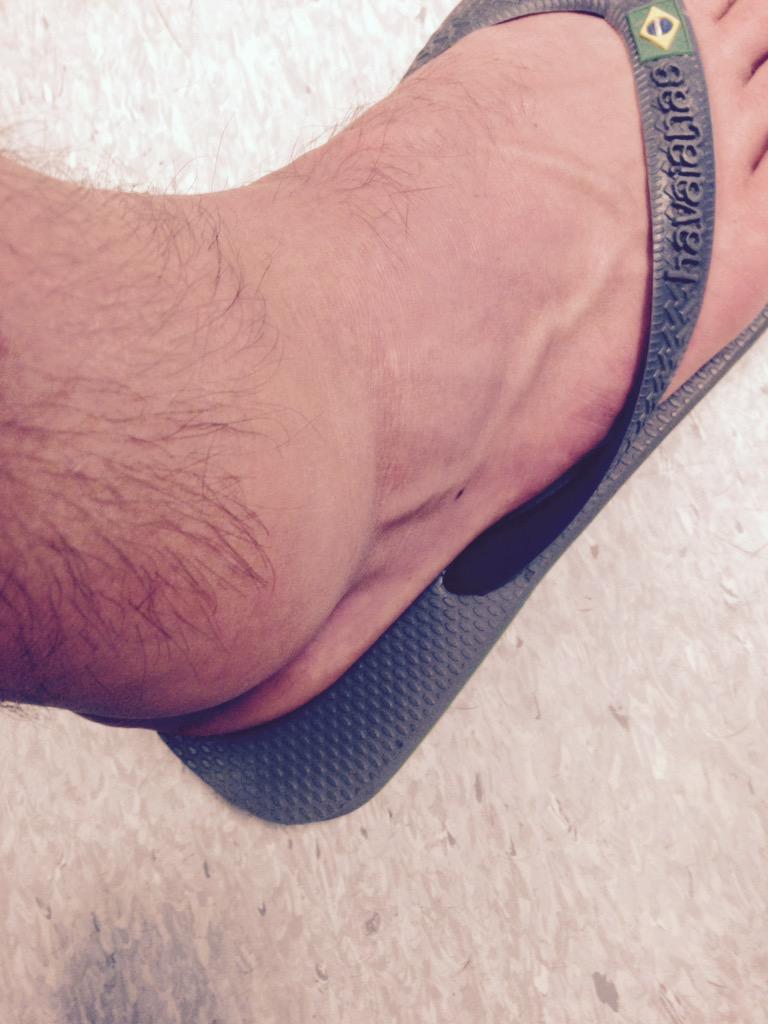 DanielMilnes's tweet photo. Just back from A and E , so glad it's not broke but ligament and crutches a few days it is - summer building now http://t.co/OqnyRUIjcg