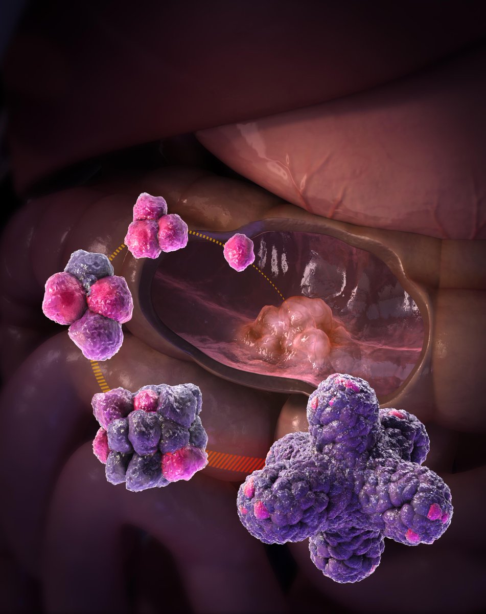 _Hubrecht's tweet photo. BIG step in cancer research: @_Hubrecht scientists create living biobank for colorectal cancer:http://t.co/WstmvzNfGh http://t.co/uTCihSHgLe