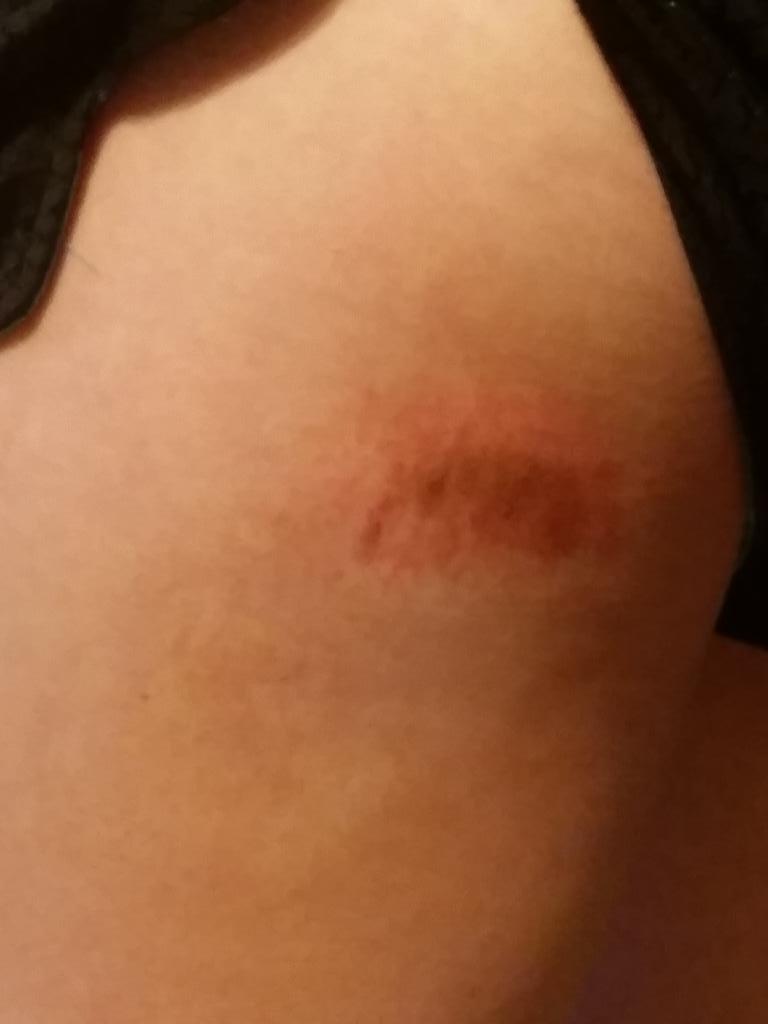 RollCLE2026's tweet photo. So Matt gets 11 stitches yesterday &amp; Grace successfully steals second &amp; slides in like a boss! #ballplayerproblems http://t.co/3zkmo3fiNV