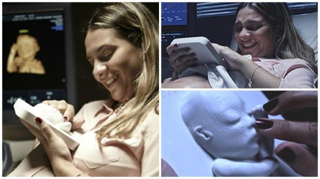'3D printed ultrasound for blind expectant mother.'

Well, this is rather lovely.