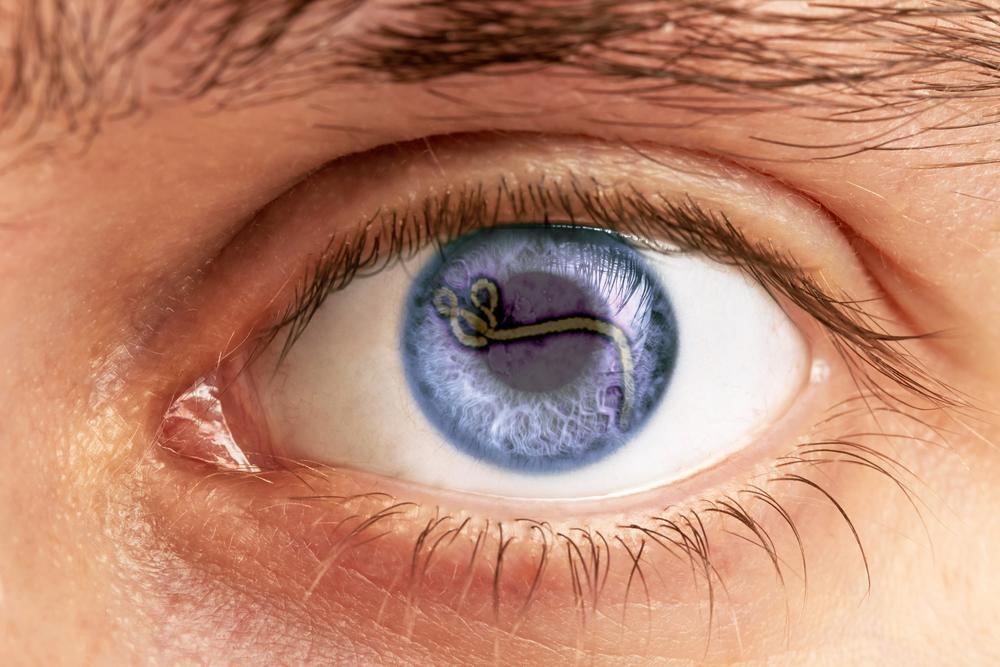 _edwardpatter's tweet photo. Ebola Lurked in Patient's Eye, Turning It From Blue to Green #nature_science http://t.co/gjoDdOZ6T9 http://t.co/IBrfUtIYms