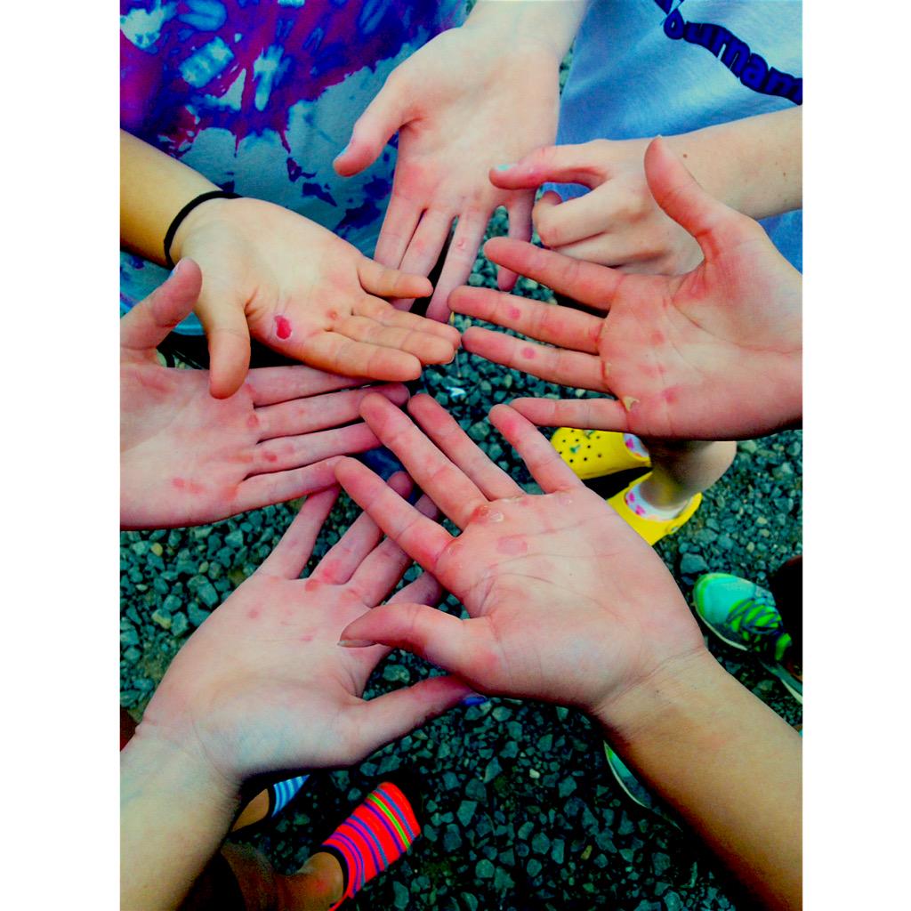 Rowerproblems's tweet image. The beauty of blisters