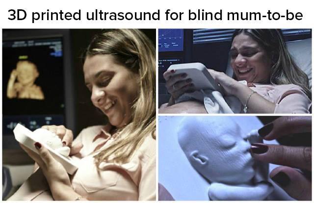 ConstructChat's tweet photo. Truly amazing!!! A 3D printed ultrasound given to the blind mum-to-be #3DPrinting #tech http://t.co/BdP07ELXMM