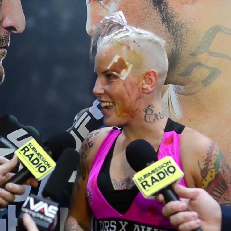 NoClassRowdyBec's tweet photo. All fucked up but still hot as fuck #UFCAdelaide http://t.co/GdsI4ionIH