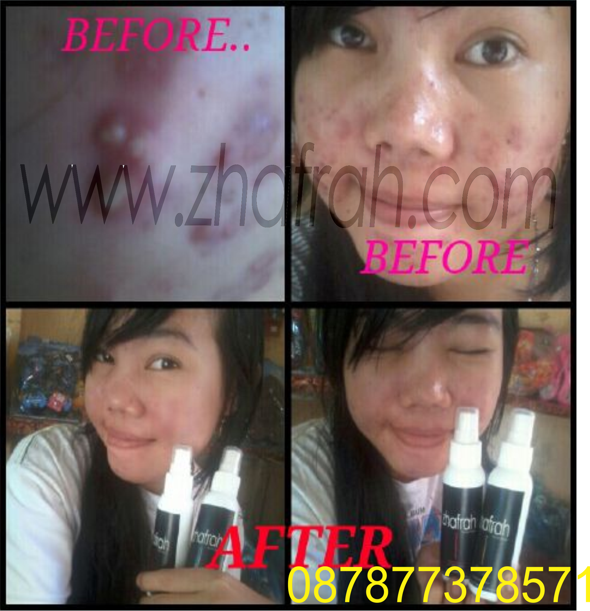 zhafrahcenter's tweet photo. masih juga penasaran sama testimoni kami ?? niih kami kasih lagi ;) https://t.co/MQtmtkKtxX