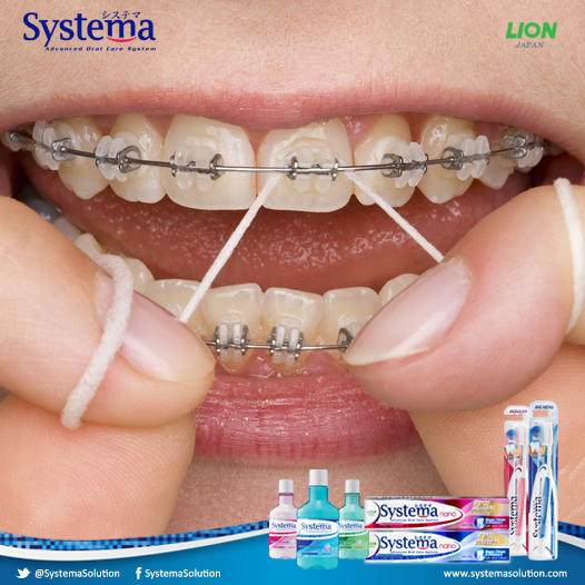 SystemaOralCare's tweet photo. Tips gigi untuk yang berbehel, gunakan benang gigi/dental floss untuk kebersihan gigi secara optimal. #TipsGigi http://t.co/9mJgJ2vj9i
