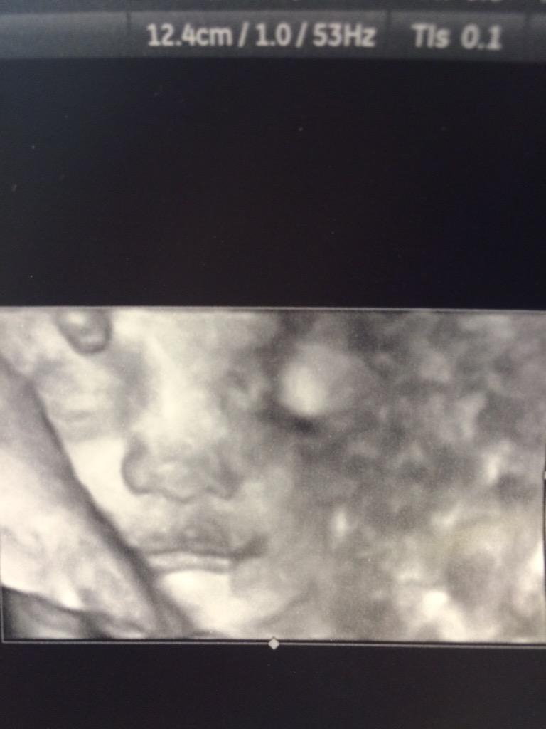 jwall81's tweet photo. Was at the check-up ultra sound today - everything's good as it seems #babyinjuly #futureWall #feelinggood http://t.co/2F3bVtYHJV