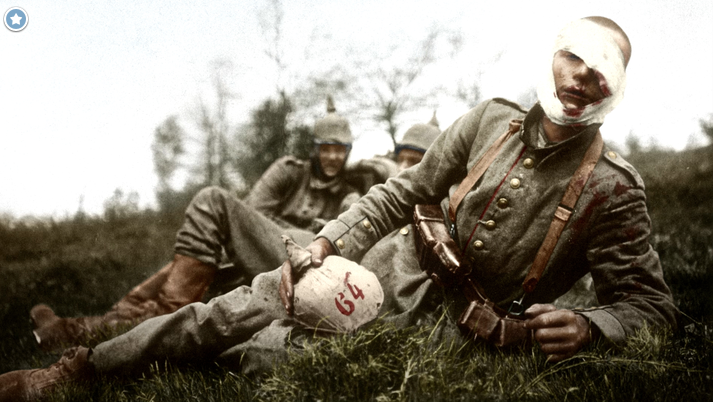Generations_14's tweet photo. Mai 1915. Ce soldat allemand est touché au visage par un éclat d'obus.
via "Apocalypse, la Première Guerre mondiale" http://t.co/p8ZtsZQeZd