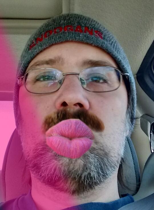 DustdevilReed's tweet image. I may have an infected lip. Not sure