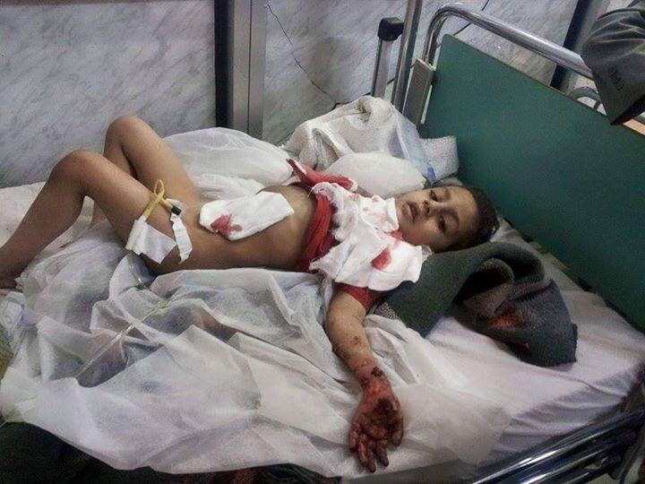Conflicto en Yemen - Página 10 CEwUFAdUEAAr_-U