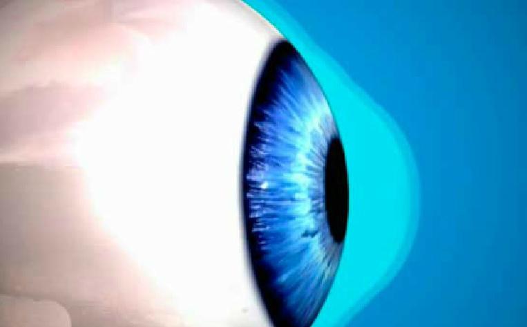 elespectador's tweet photo. Rascarse los ojos puede deformar la córnea. http://t.co/tKV2ZcGGqC http://t.co/XBfdnsFTmV