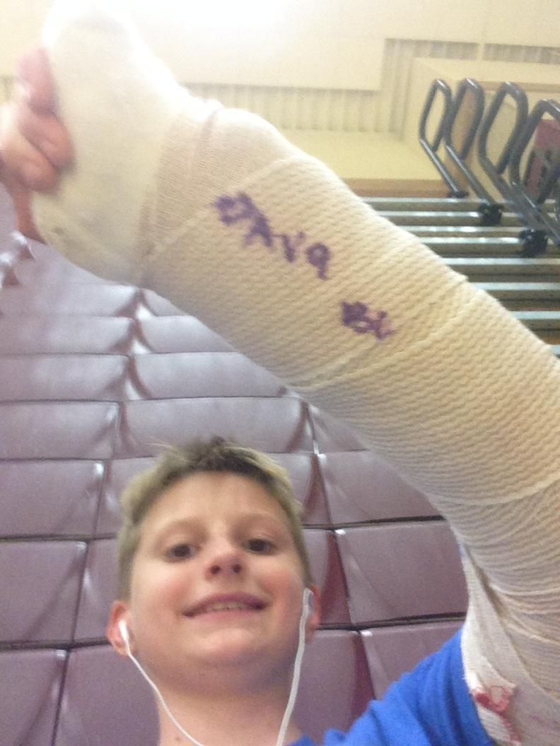 stinktanklabs's tweet photo. Idaho, @glennbeck 's ranch, ATV accident, pole came down and destroyed my arm #winit #god-blessed-us👼 http://t.co/ERrf5TjETf