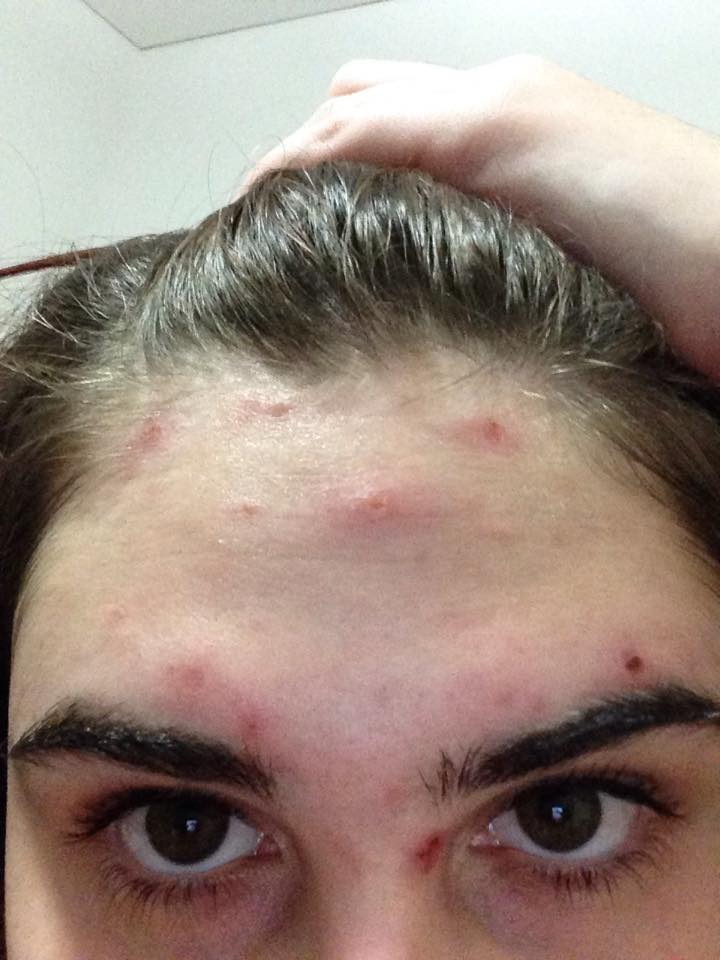 moogoo blemish cleansing moisturiser