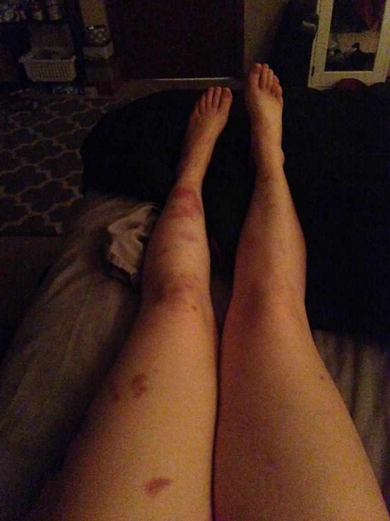carolinebingy's tweet photo. RIP ME http://t.co/krCRnVFj3e