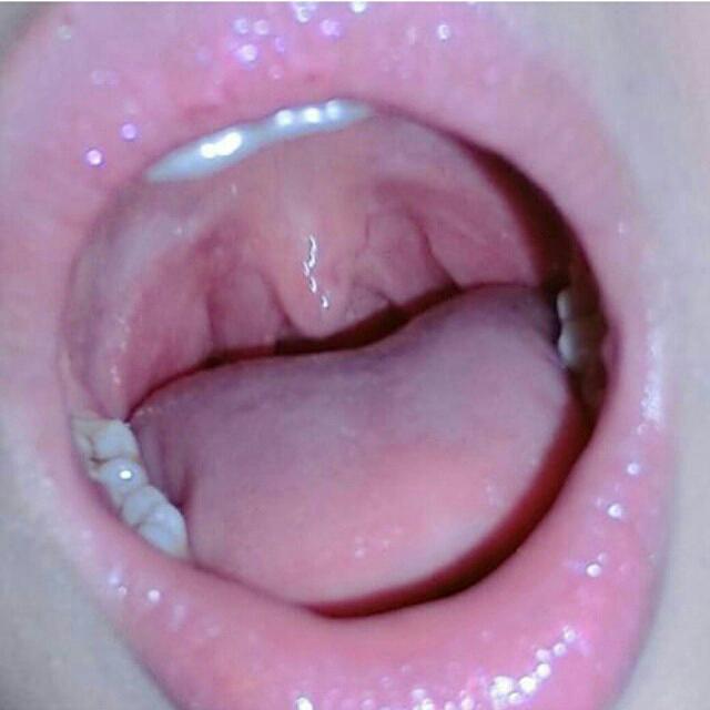 Kurang kerjaan, Selfie mulut wkwkw :D