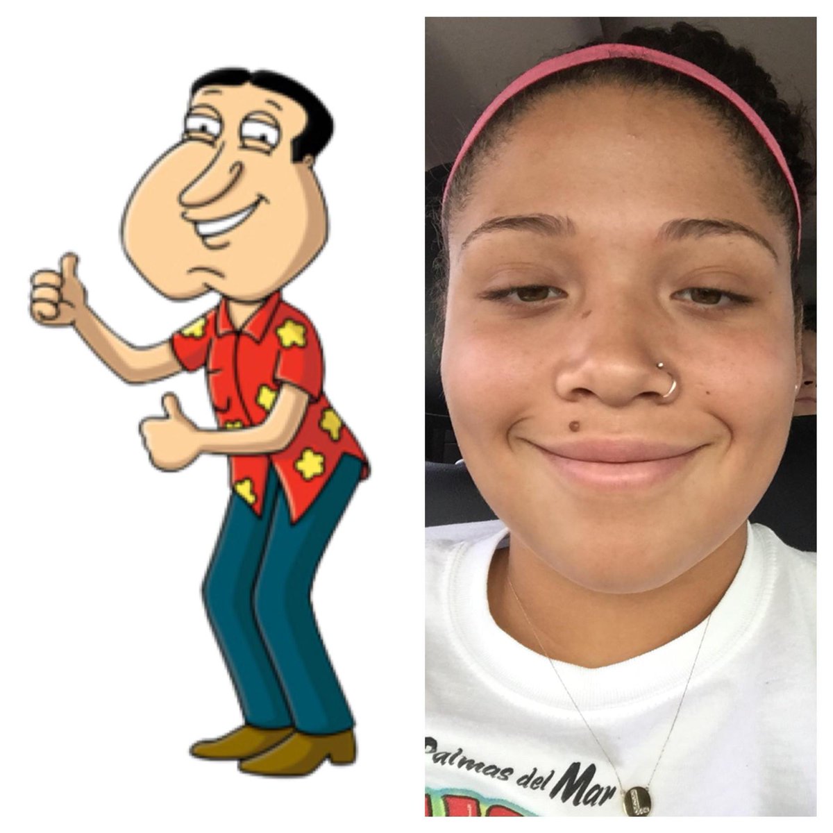LMG_1322's tweet image. I look like freakin quagmire😭😂 #wisdomteethprobs