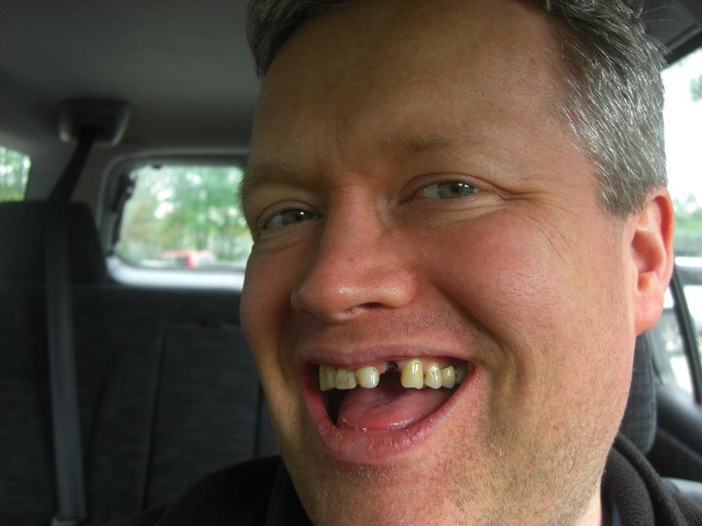 dollarstore's tweet photo. @DollarTree Jeremy needs your help. Please visit GoFundMe and help him get a front tooth. http://t.co/3JoRg8RrYF http://t.co/rF7IHbaO9m