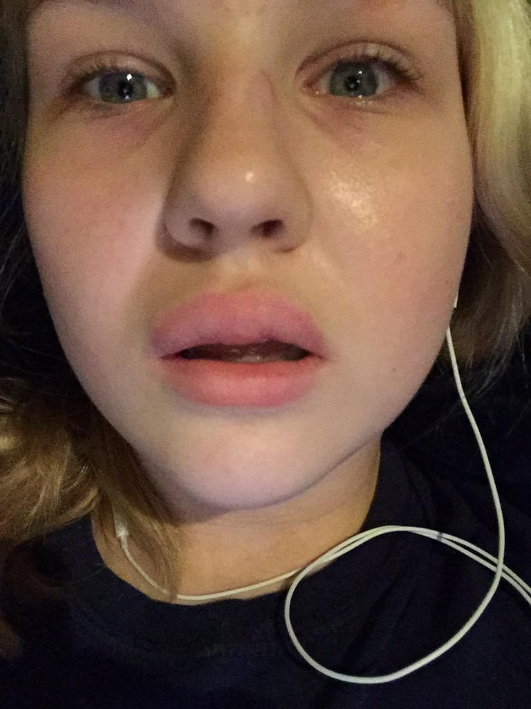 sadie_saxon's tweet photo. if only this was from the Kylie Jenner challenge ๐ #smashedmyface http://t.co/X7gg6wQ3l8