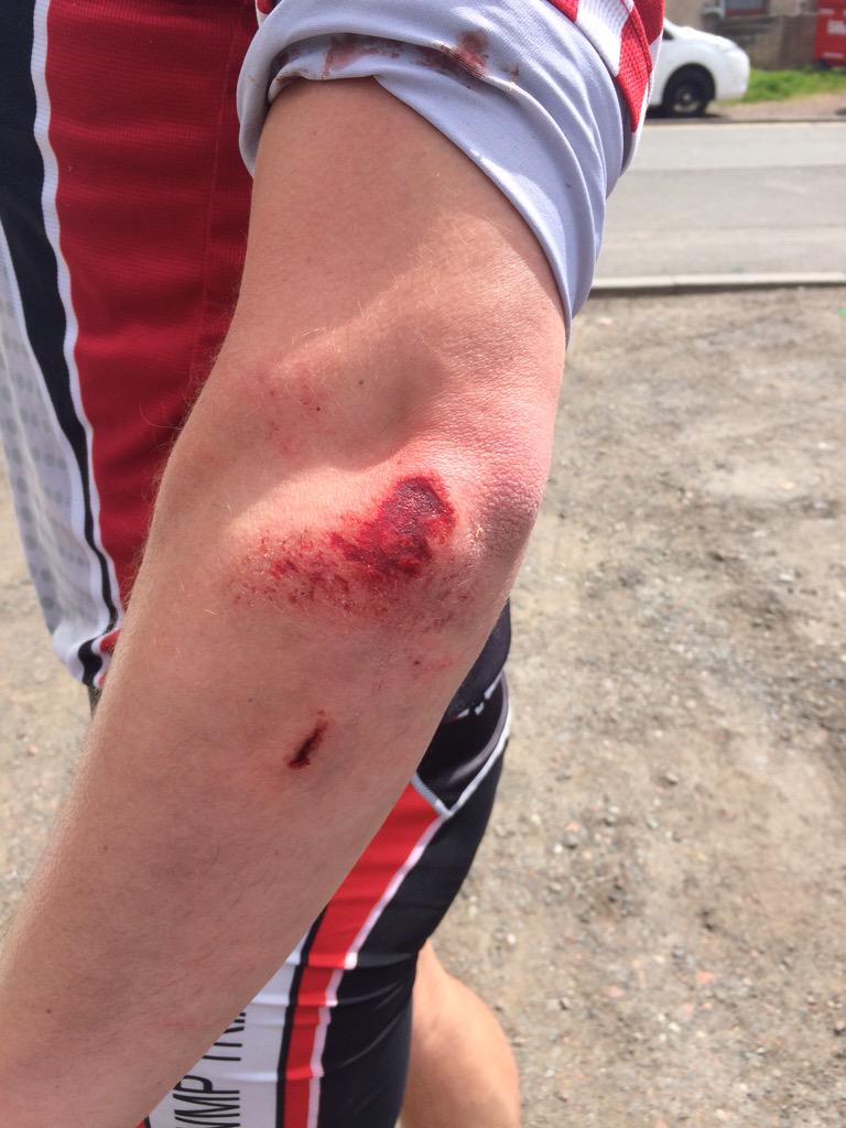 2wheels3peaks's tweet photo. For today's amusement @Dutts9 had a crash at the 25 mile point. 🚴🏻💥🚴🏻!! #getagripofyourself ! http://t.co/IpZDbRxfCM