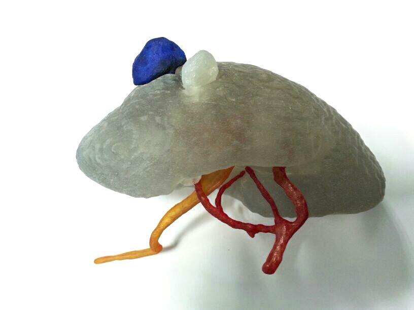 3dprintindustry's tweet image. Italian Surgeons Seek Crowdfunding to Offer Medical #3Dprinting Services 3dpi.net//308 via @3DPrintIndustry