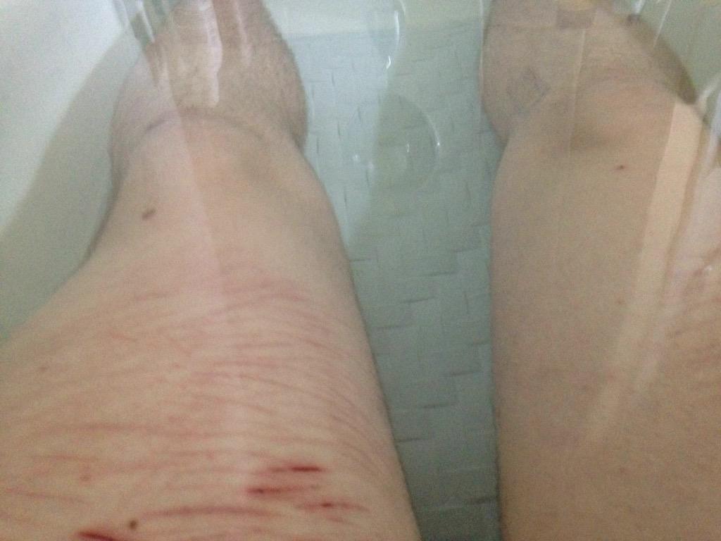 Skin burning bath is the best kinda bath