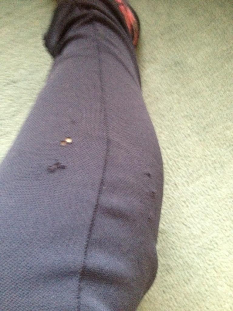 rouse_liam's tweet photo. Teeth marks from that fu**ing dog @BandPCC http://t.co/170tRnC3is