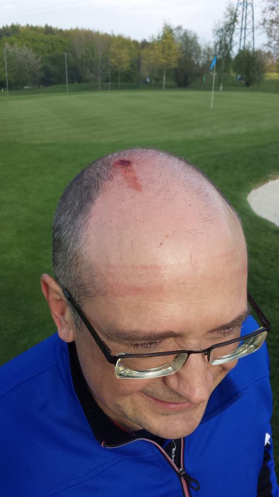 Od teď jsem praštěný  míčkem...