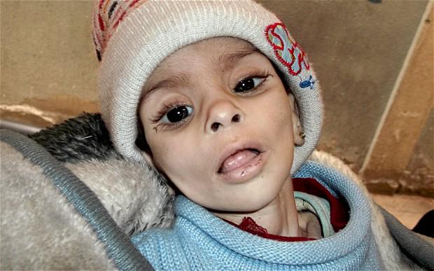 islamicfreedom's tweet photo. How can we not give after seeing his face?

If this was YOU,

would you want help?

$10 EACH

http://t.co/INtmN1vn7J http://t.co/FKgvGmID1m