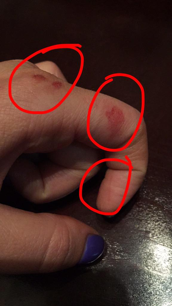 julia_mcdow's tweet image. When you buy new shears and they are too sharp. #hairdresserlife #hairstylistprobs #pointcutting #dryhands 🙅🏽💇🏻